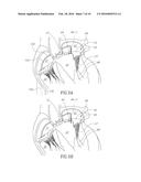 CARDIAC VALVE COMMISSURE BRACE diagram and image