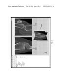 Kinematic and Parameterized Modeling for Patient-Adapted Implants, Tools,     and Surgical Procedures diagram and image