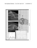 Kinematic and Parameterized Modeling for Patient-Adapted Implants, Tools,     and Surgical Procedures diagram and image