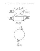 BIODEGRADABLE ENDOPROSTHESES AND METHODS OF THEIR FABRICATION diagram and image