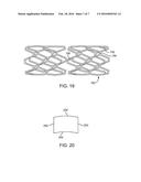 BIODEGRADABLE ENDOPROSTHESES AND METHODS OF THEIR FABRICATION diagram and image