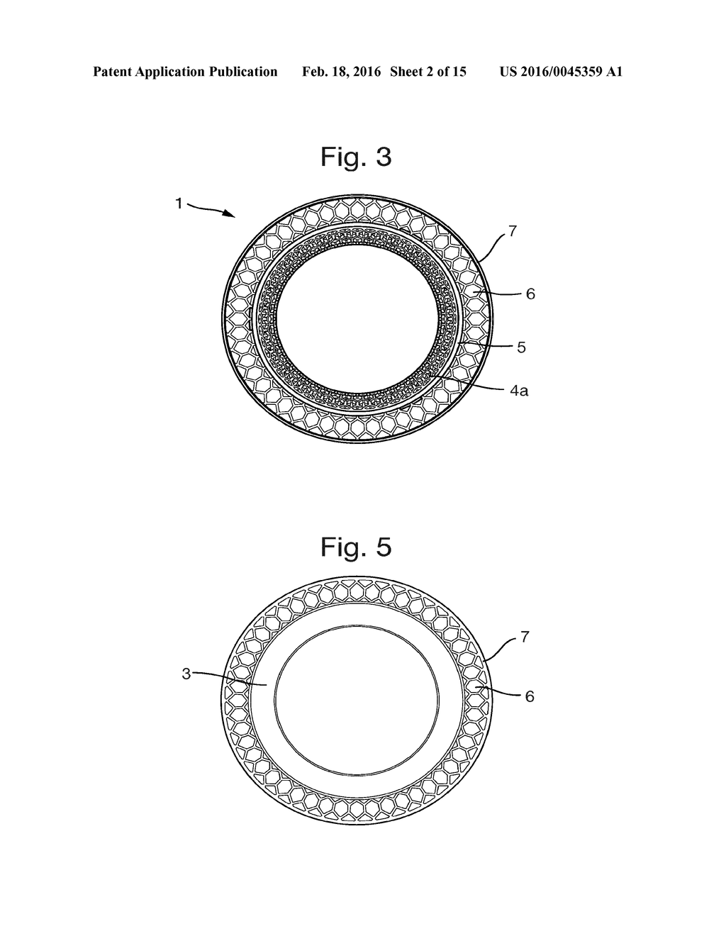 IMPLANT ADAPTOR - diagram, schematic, and image 03