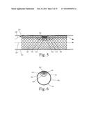 Implanted Extracardiac Device for Circulatory Assistance diagram and image