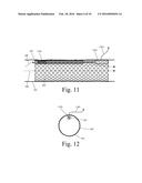 Implanted Extracardiac Device for Circulatory Assistance diagram and image