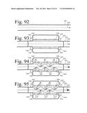 Implanted Extracardiac Device for Circulatory Assistance diagram and image