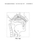 NASAL ADMINISTRATION diagram and image