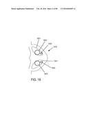 METHODS, SYSTEMS AND DEVICES FOR NON-INVASIVE OPEN VENTILATION WITH GAS     DELIVERY NOZZLES WITH AN OUTER TUBE diagram and image