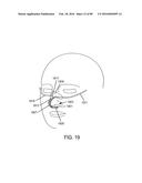 METHODS, SYSTEMS AND DEVICES FOR NON-INVASIVE OPEN VENTILATION WITH GAS     DELIVERY NOZZLES WITH AN OUTER TUBE diagram and image