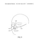 METHODS, SYSTEMS AND DEVICES FOR NON-INVASIVE OPEN VENTILATION WITH GAS     DELIVERY NOZZLES WITH AN OUTER TUBE diagram and image