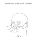 METHODS, SYSTEMS AND DEVICES FOR NON-INVASIVE OPEN VENTILATION WITH GAS     DELIVERY NOZZLES WITH AN OUTER TUBE diagram and image