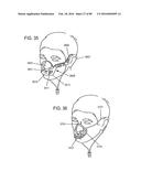 METHODS, SYSTEMS AND DEVICES FOR NON-INVASIVE OPEN VENTILATION WITH GAS     DELIVERY NOZZLES WITH AN OUTER TUBE diagram and image