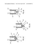 METHODS, SYSTEMS AND DEVICES FOR NON-INVASIVE OPEN VENTILATION WITH GAS     DELIVERY NOZZLES WITH AN OUTER TUBE diagram and image