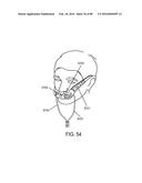 METHODS, SYSTEMS AND DEVICES FOR NON-INVASIVE OPEN VENTILATION WITH GAS     DELIVERY NOZZLES WITH AN OUTER TUBE diagram and image