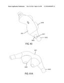 METHODS, SYSTEMS AND DEVICES FOR NON-INVASIVE OPEN VENTILATION WITH GAS     DELIVERY NOZZLES WITH AN OUTER TUBE diagram and image