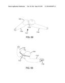 METHODS, SYSTEMS AND DEVICES FOR NON-INVASIVE OPEN VENTILATION WITH GAS     DELIVERY NOZZLES WITH AN OUTER TUBE diagram and image