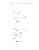 METHODS, SYSTEMS AND DEVICES FOR NON-INVASIVE OPEN VENTILATION WITH GAS     DELIVERY NOZZLES WITH AN OUTER TUBE diagram and image