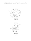 METHODS, SYSTEMS AND DEVICES FOR NON-INVASIVE OPEN VENTILATION WITH GAS     DELIVERY NOZZLES WITH AN OUTER TUBE diagram and image