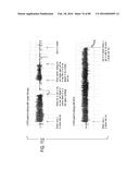 METHODS, SYSTEMS AND DEVICES FOR NON-INVASIVE OPEN VENTILATION WITH GAS     DELIVERY NOZZLES WITH AN OUTER TUBE diagram and image