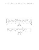 SYSTEM AND METHOD FOR ENHANCING SLEEP SLOW WAVE ACTIVITY BASED ON CARDIAC     ACTIVITY diagram and image