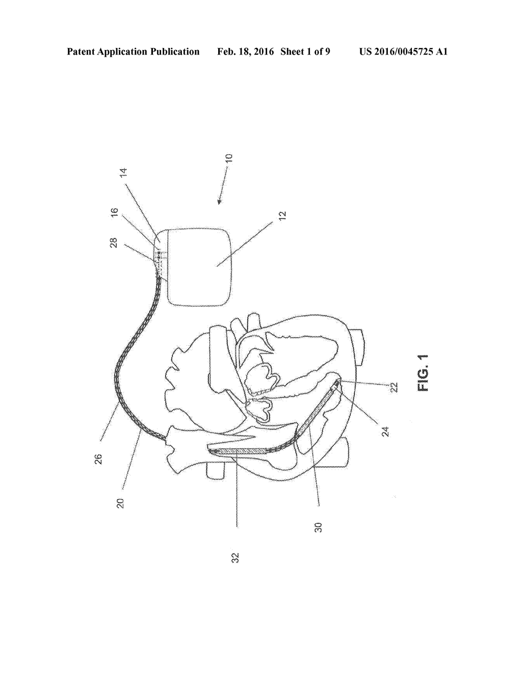 IMPLANTABLE DEVICE WITH ELECTRICAL FILTER - diagram, schematic, and image 02