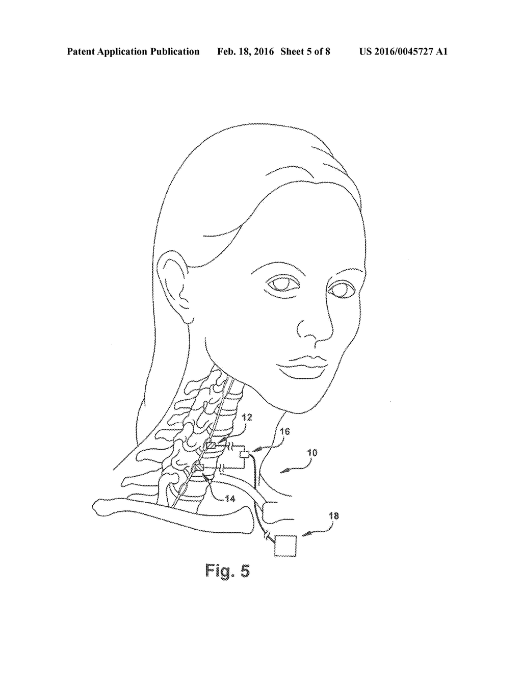 SYSTEMS AND METHODS FOR TREATING AUTONOMIC INSTABILITY AND MEDICAL     CONDITIONS ASSOCIATED THEREWITH - diagram, schematic, and image 06