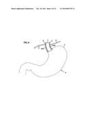 TREATMENT OF EXCESS WEIGHT BY NEURAL DOWNREGULATION IN COMBINATION WITH     COMPOSITIONS diagram and image