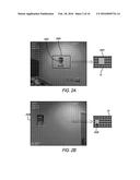 Pattern Detection and Location Indication for a Visual Prosthesis diagram and image