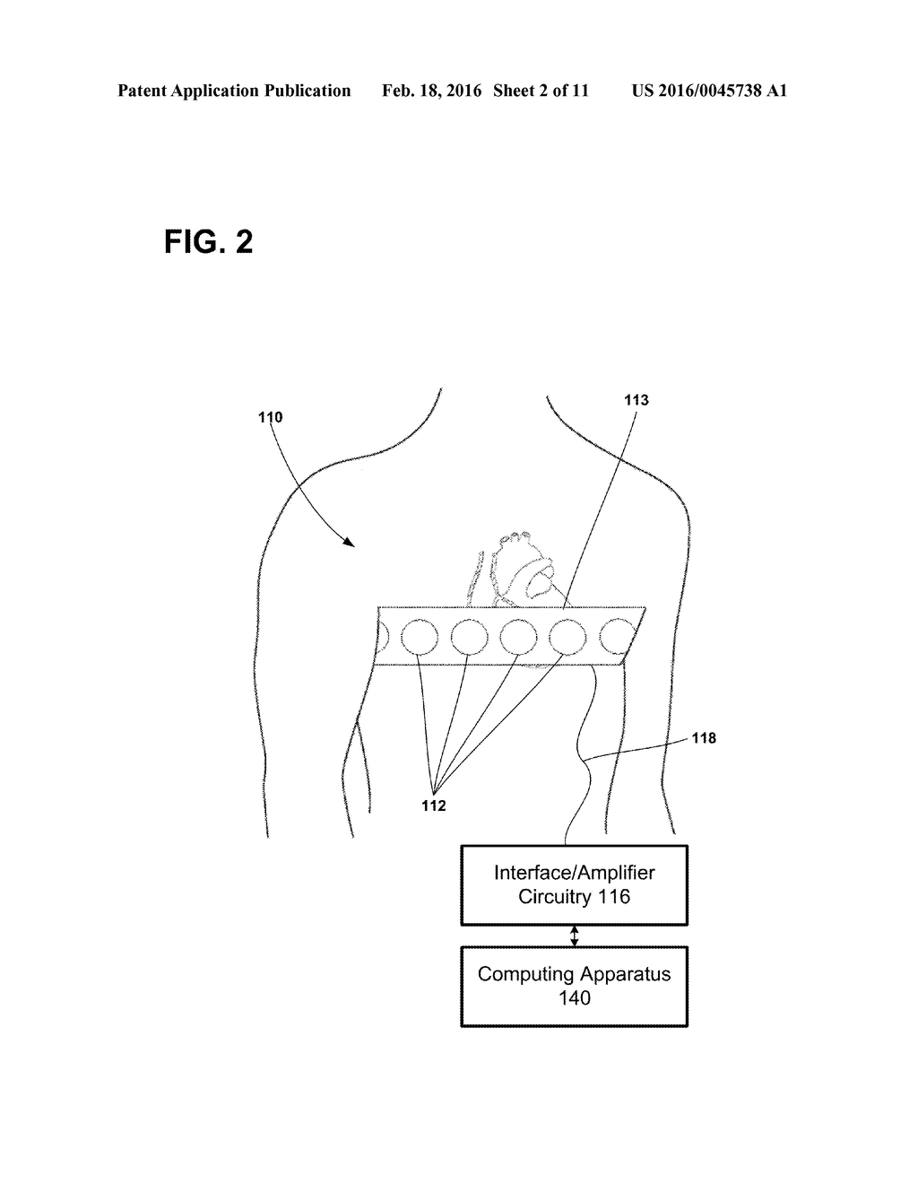SYSTEMS AND METHODS FOR CONFIGURATION OF ATRIOVENTRICULAR INTERVAL - diagram, schematic, and image 03