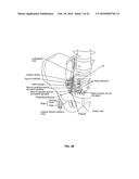 Integrated Electromyographic Clinician Programmer for Use with an     Implantable Neurostimulator diagram and image