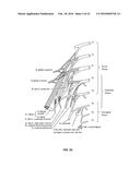 Integrated Electromyographic Clinician Programmer for Use with an     Implantable Neurostimulator diagram and image