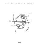 Integrated Electromyographic Clinician Programmer for Use with an     Implantable Neurostimulator diagram and image