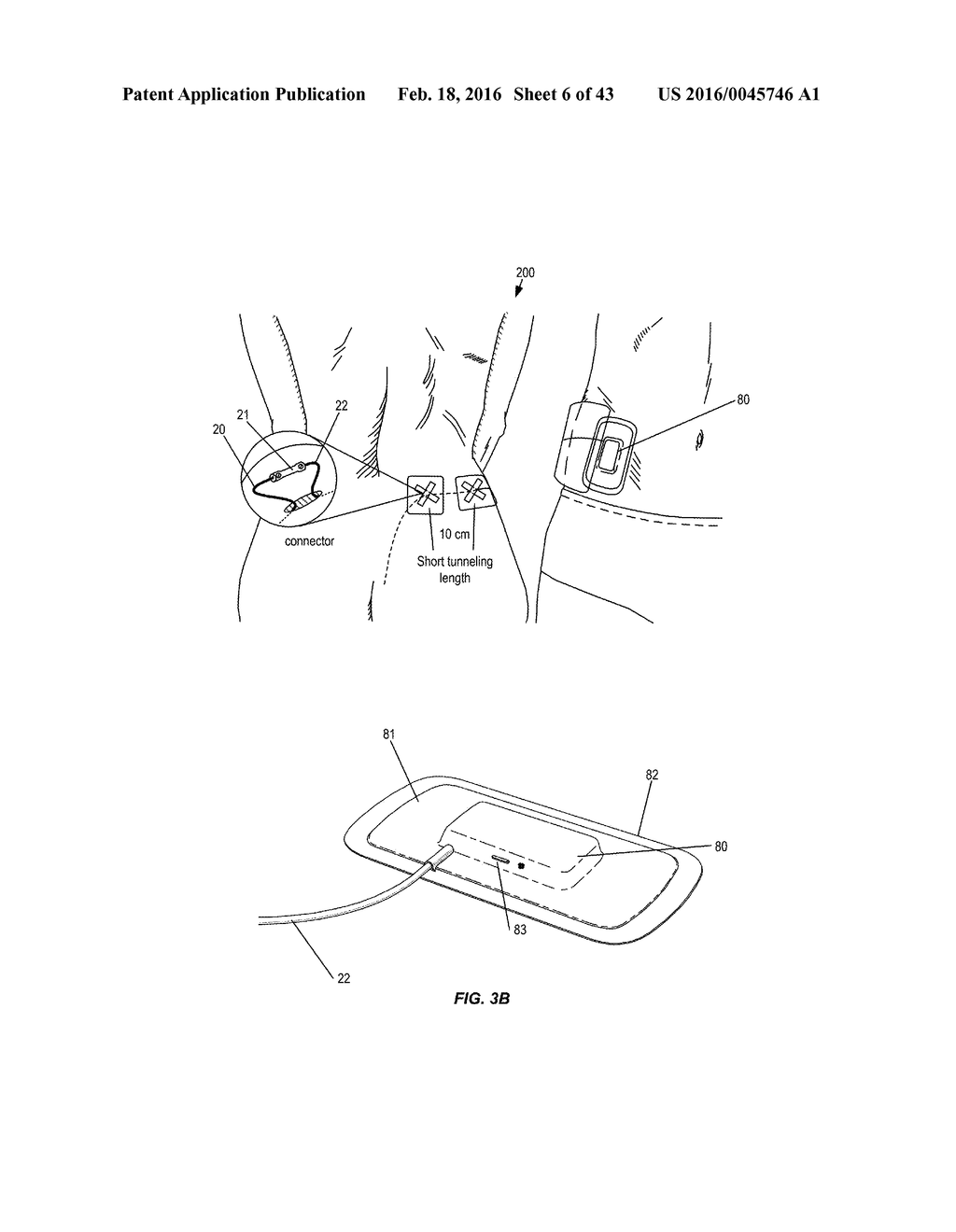 Integrated Electromyographic Clinician Programmer for Use with an     Implantable Neurostimulator - diagram, schematic, and image 07