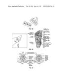 Integrated Electromyographic Clinician Programmer for Use with an     Implantable Neurostimulator diagram and image