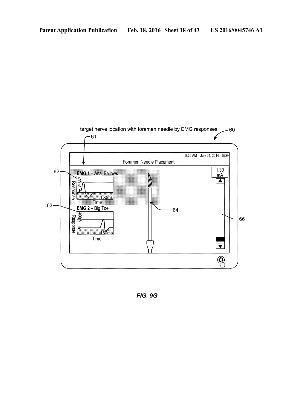 Integrated Electromyographic Clinician Programmer for Use with an     Implantable Neurostimulator - diagram, schematic, and image 19