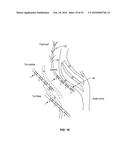 Integrated Electromyographic Clinician Programmer for Use with an     Implantable Neurostimulator diagram and image