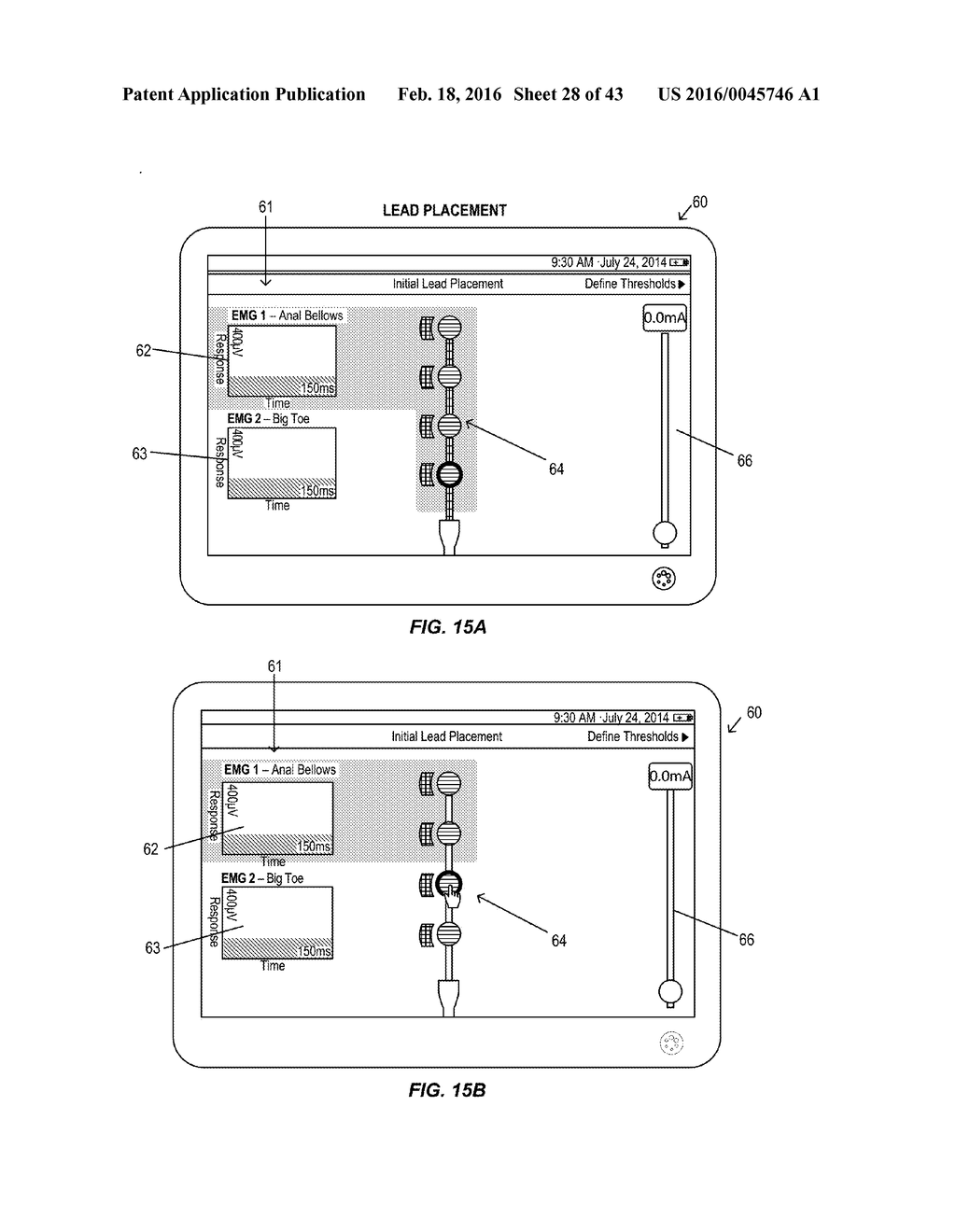 Integrated Electromyographic Clinician Programmer for Use with an     Implantable Neurostimulator - diagram, schematic, and image 29