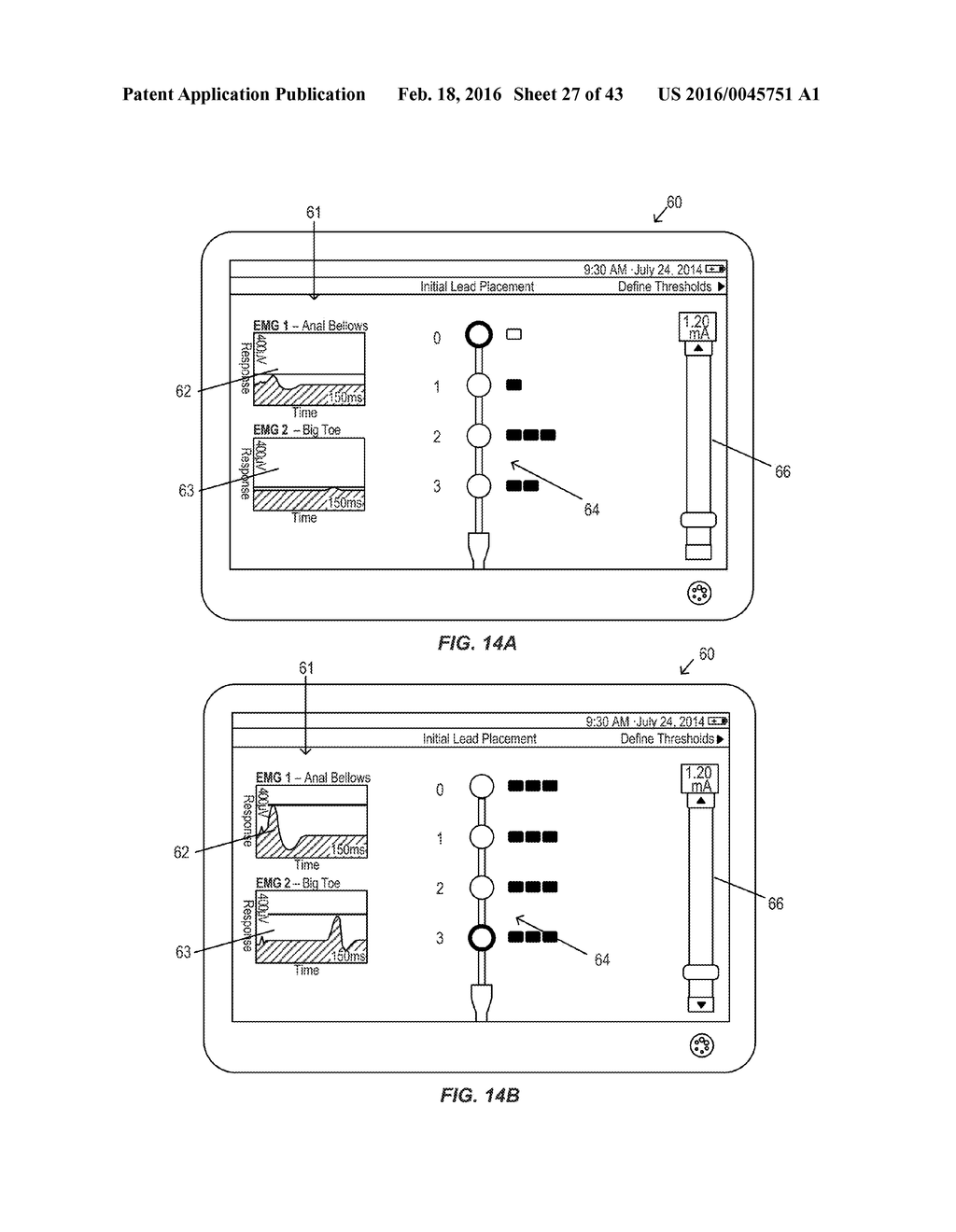 Systems and Methods for Neurostimulation Electrode Configurations Based on     Neural Localization - diagram, schematic, and image 28