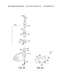 INTERCHANGEABLE SHAFT SYSTEM diagram and image