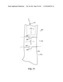 INTERCHANGEABLE SHAFT SYSTEM diagram and image