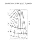 ARTICULATING VEHICLE BELLOWS diagram and image