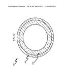 Wellbore Plug Isolation System and Method diagram and image