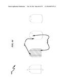 Wellbore Plug Isolation System and Method diagram and image