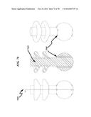 Wellbore Plug Isolation System and Method diagram and image