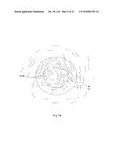 Prechamber Ignition System diagram and image