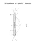 APPARATUS BODY HEAT DISSIPATION DEVICE diagram and image