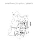 UNIVERSAL REMOTE TRIGGER ACTUATOR diagram and image