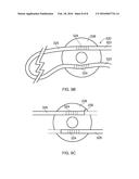 METHODS, DEVICE AND APPARATUS FOR EVALUATING ELECTRICAL CURRENT THREAT     EFFECTS AT JOINTS diagram and image