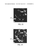 PERFUSION IMAGING diagram and image