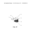 MOVABLE SENSING DEVICE FOR STRINGED MUSICAL INSTRUMENTS diagram and image