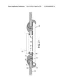 Wire Bond Sensor Package And Method diagram and image